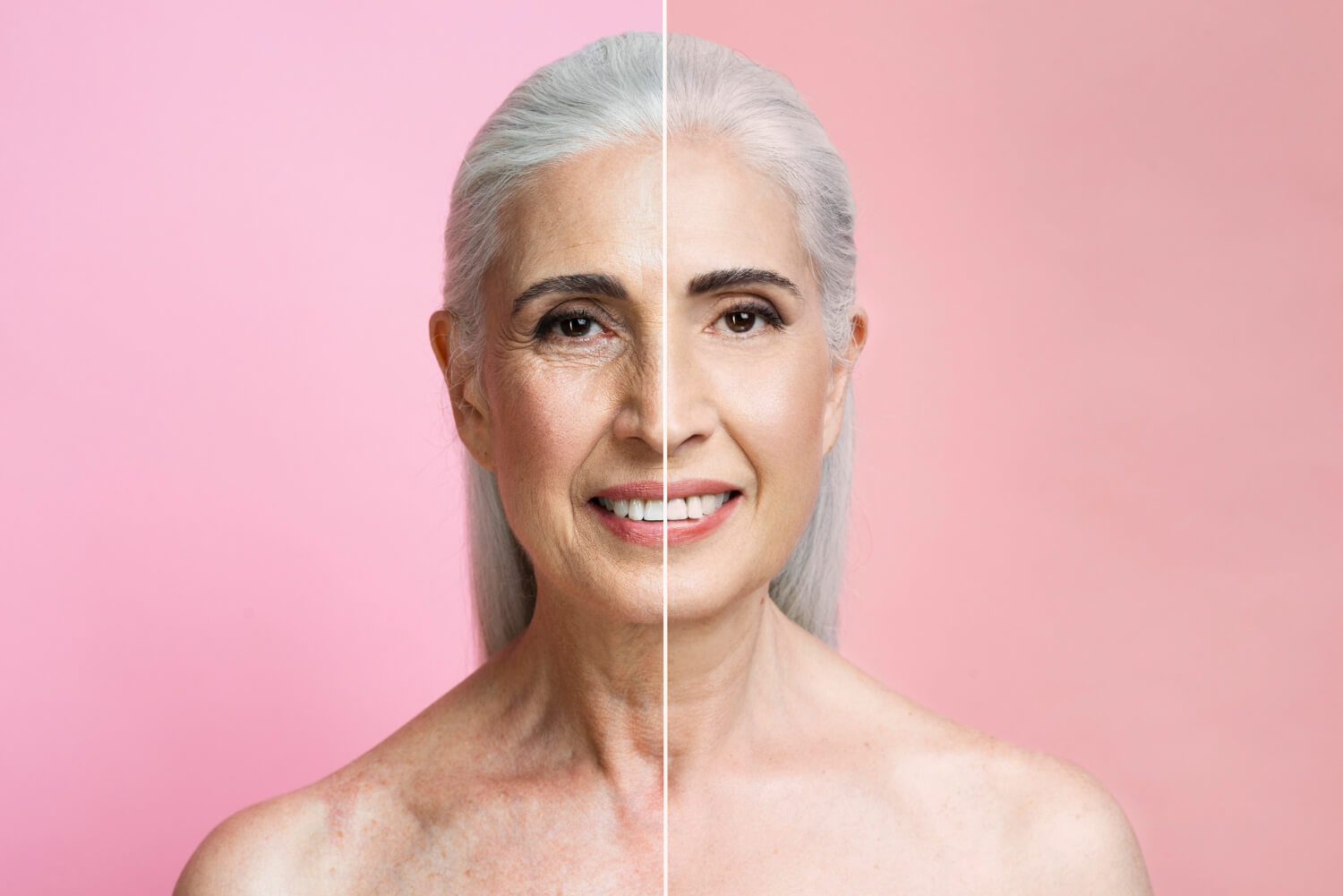  mature woman's face before and after anti-aging treatment ad med spa